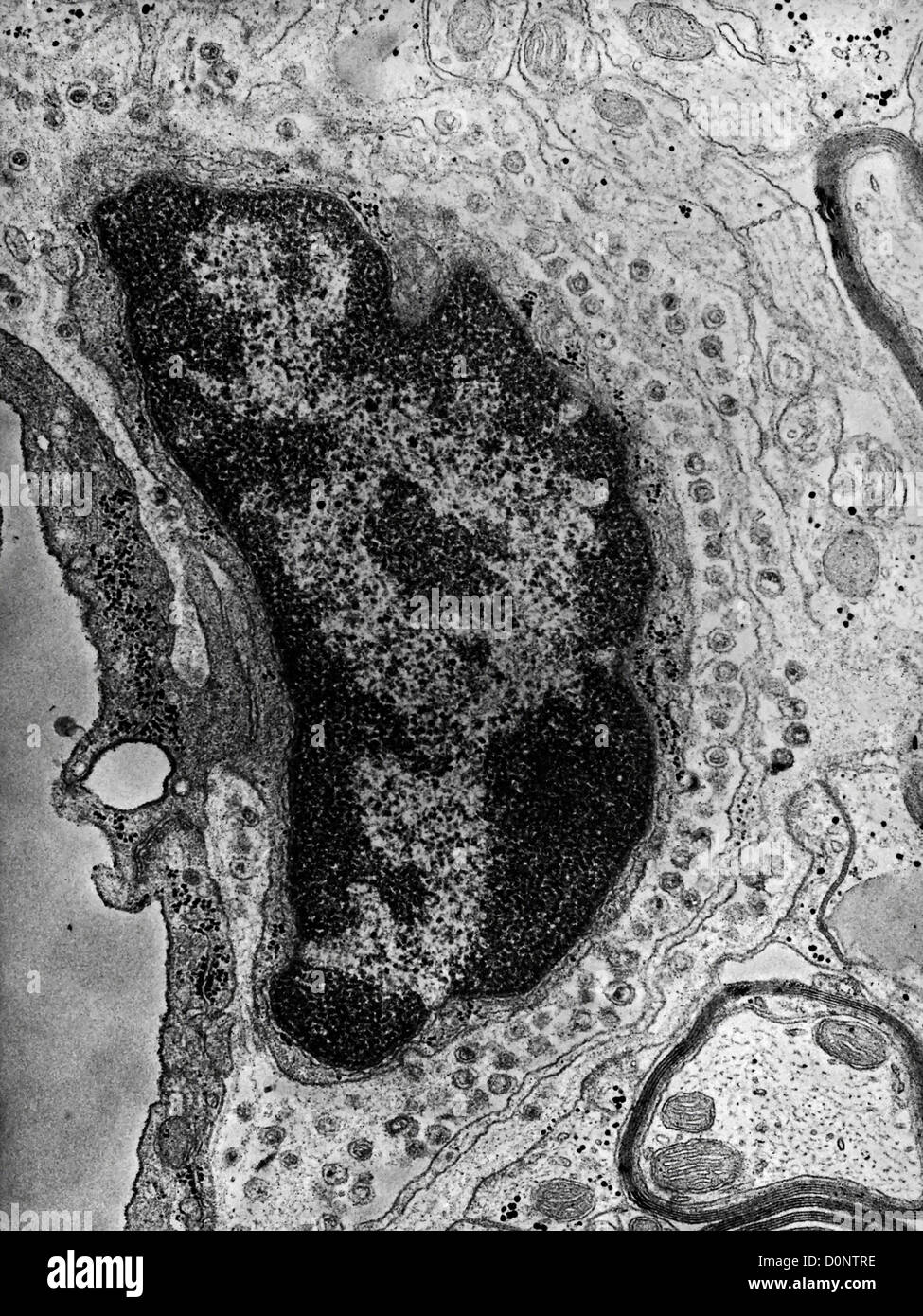 This negatively-stained transmission electron micrograph (TEM) revealed presence numerous intracellular Group C RNA tumor virus Stock Photo
