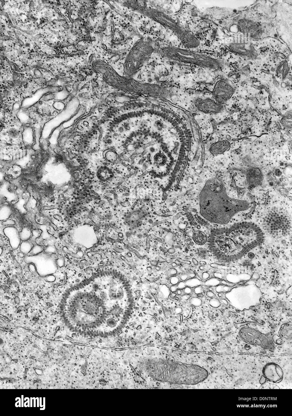 This transmission electron micrograph (TEM) revealed presence number Eastern Equine Encephalitis (EEE) virus virions that Stock Photo