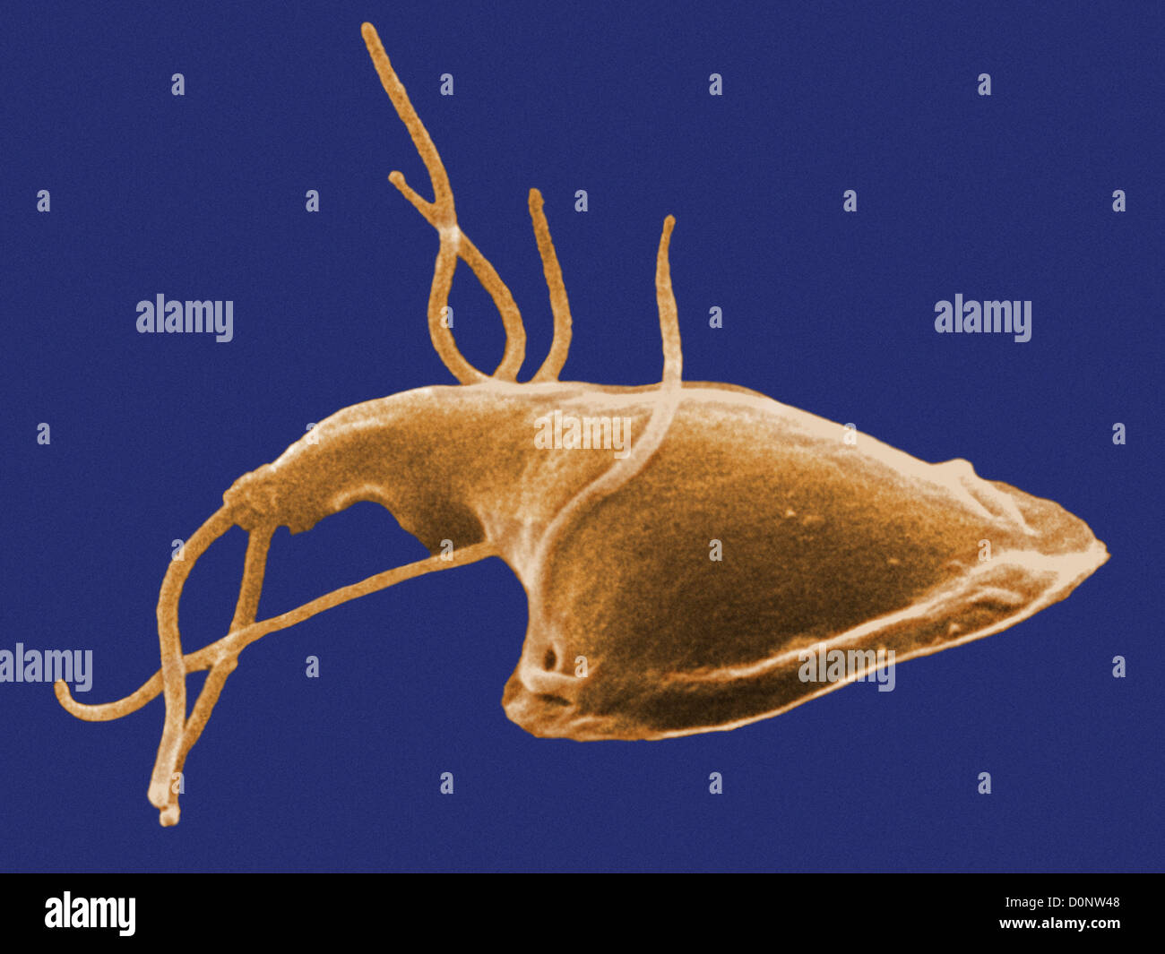 This digitally-colorized scanning electron micrograph (SEM) depicted dorsal (upper) surface Giardia protozoan that had been Stock Photo