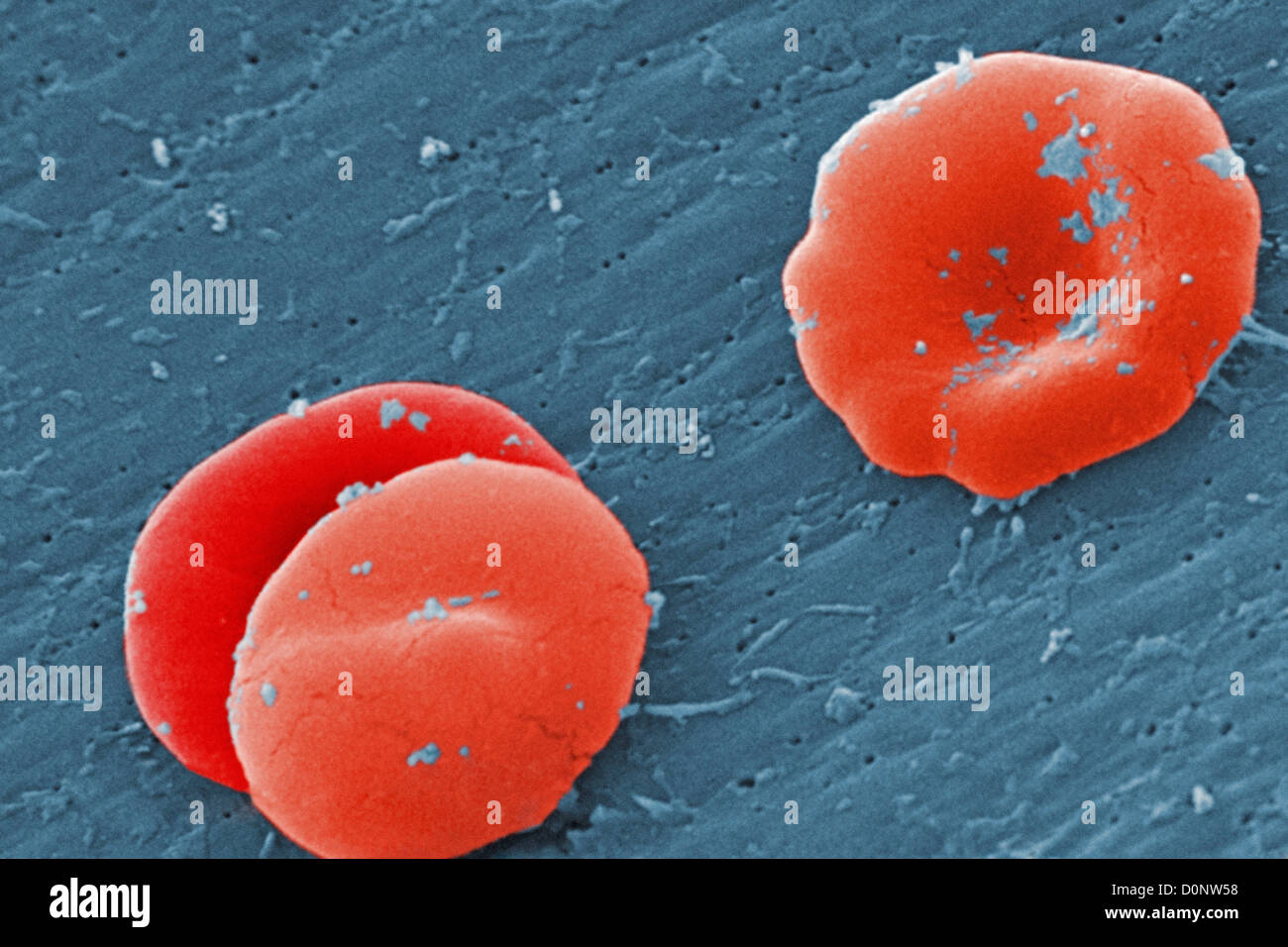 Under high magnification 8000X this scanning electron micrograph (SEM ...