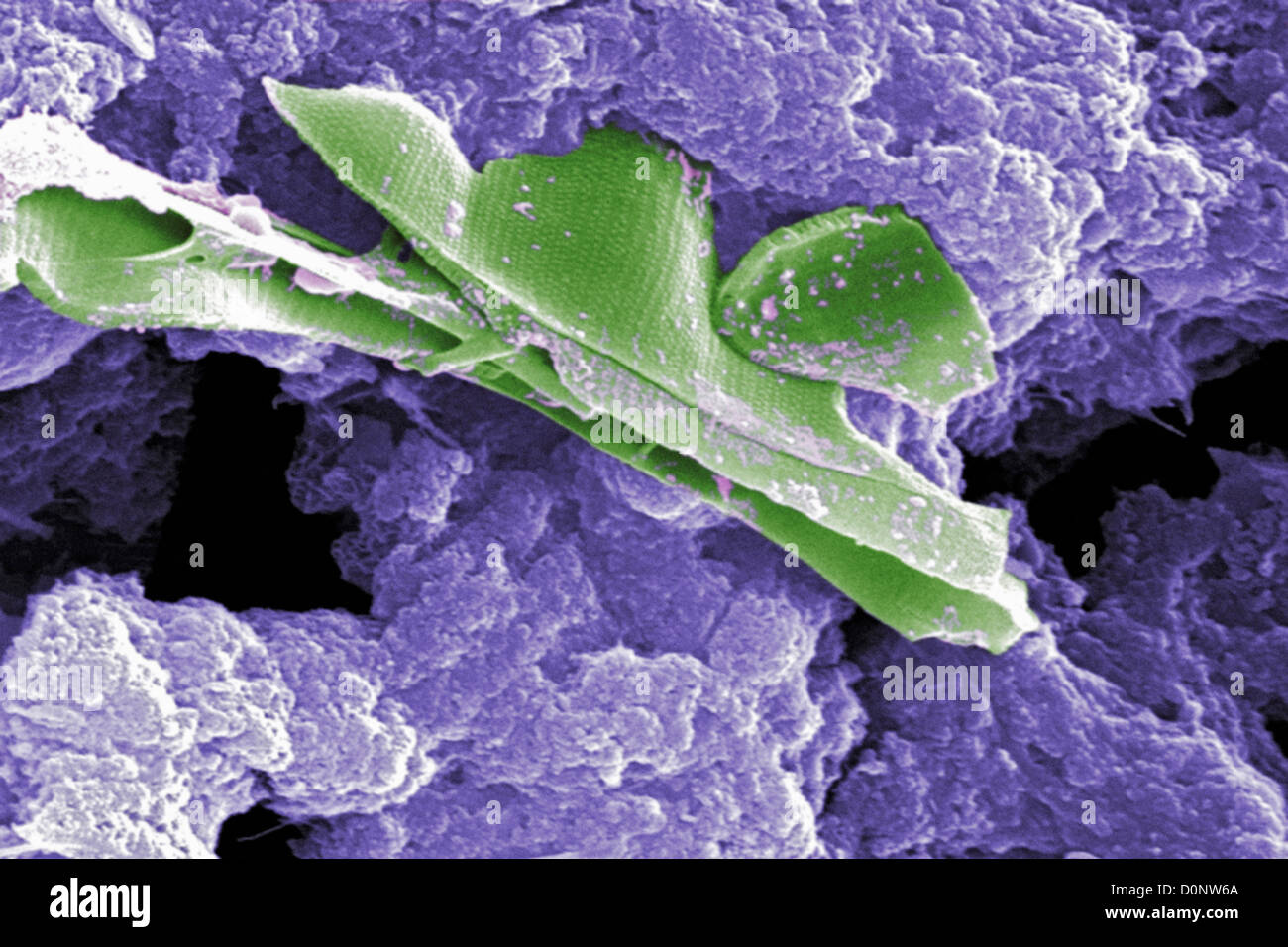 This digitally-colorized scanning electron micrograph (SEM) untreated ...