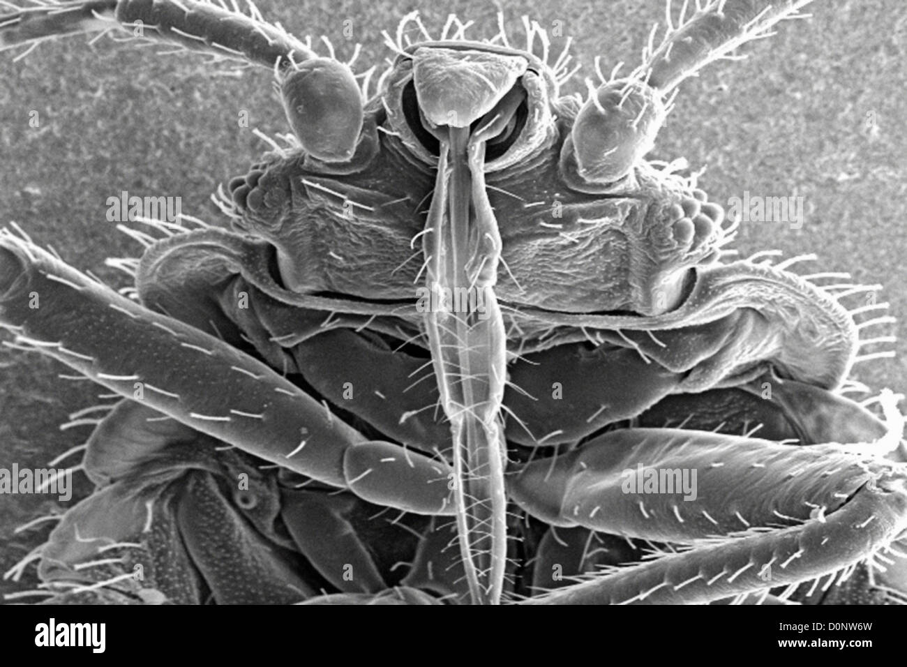 This scanning electron micrograph (SEM) revealed some ultrastructural ...