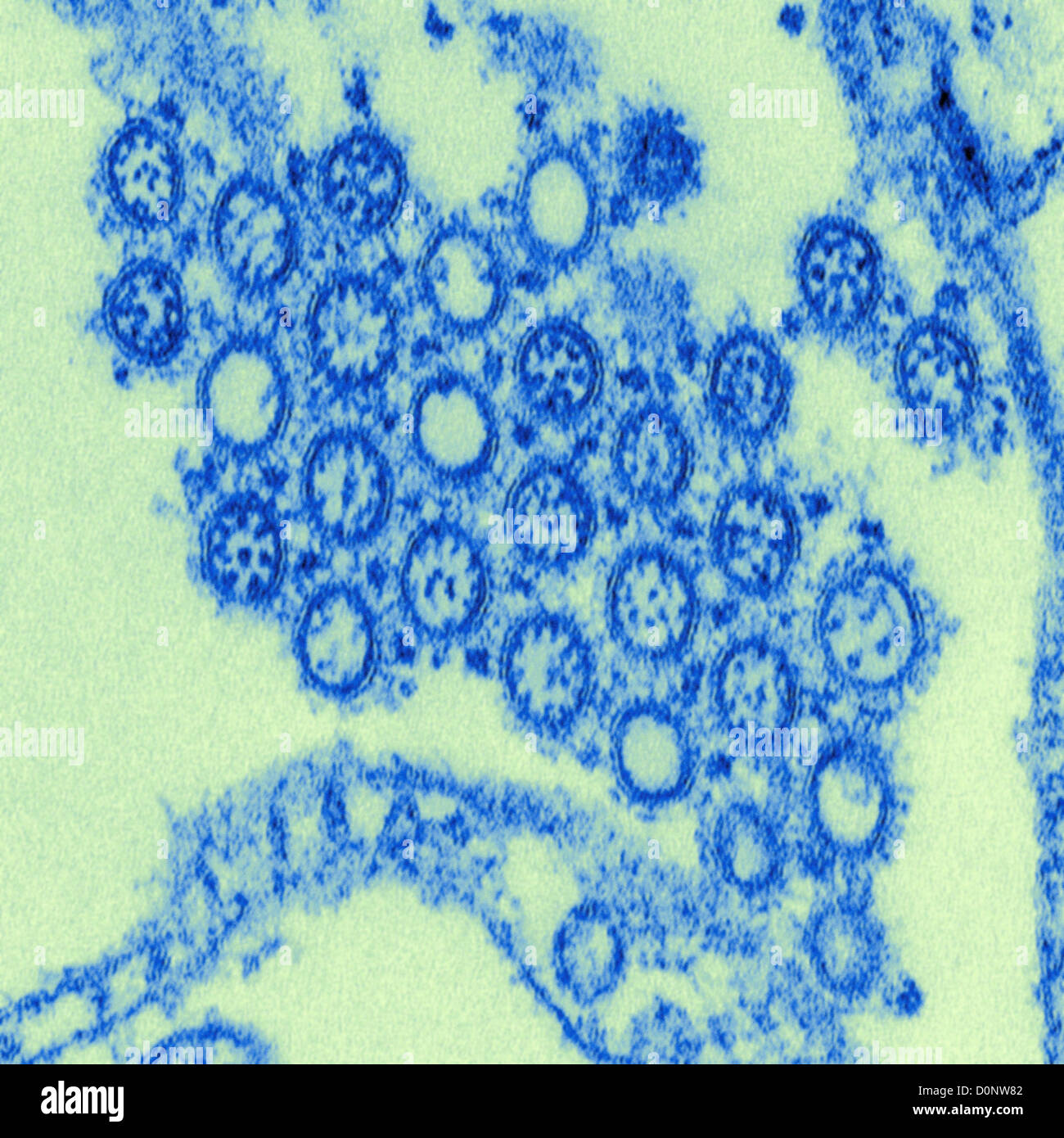 This highly-magnified digitally-colorized transmission electron micrograph (TEM) depicted numbers virions Novel Flu H1N1 Stock Photo