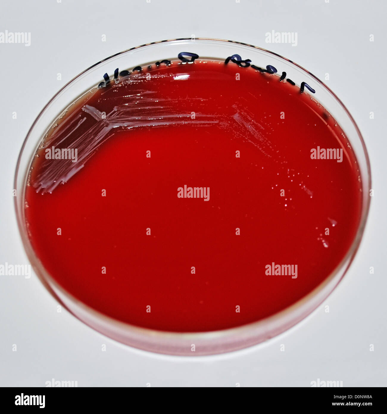 Colonies Brucella abortus bacteria which have been cultivated on sheep?s blood agar (SBA) period 48 hours. This bacteria is Stock Photo