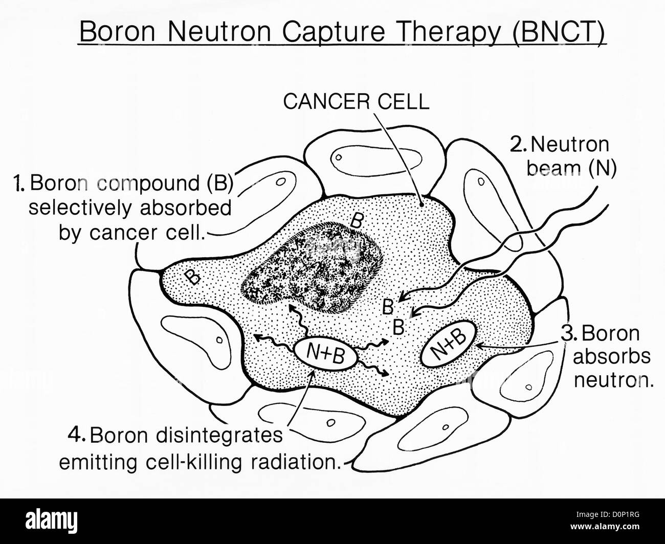 An illustration Boron Neutron Capture Therapy (BNCT) type treatment cancer. 1) Boron compound (b) is selectively absorbed Stock Photo