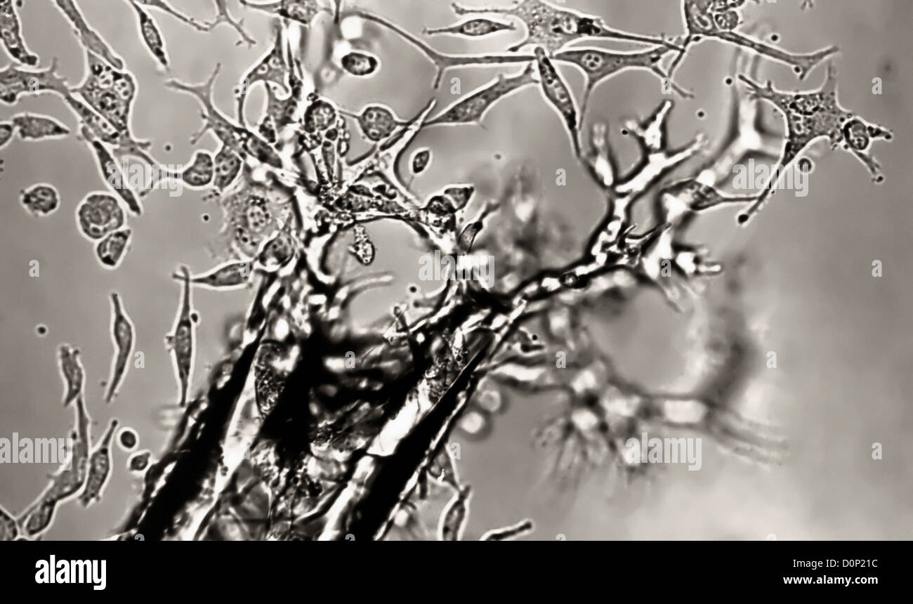 Multiple cells grown in tissue culture in laboratory Dr. Wilton R. Earle National Cancer Institute. Earle was first grow cells Stock Photo