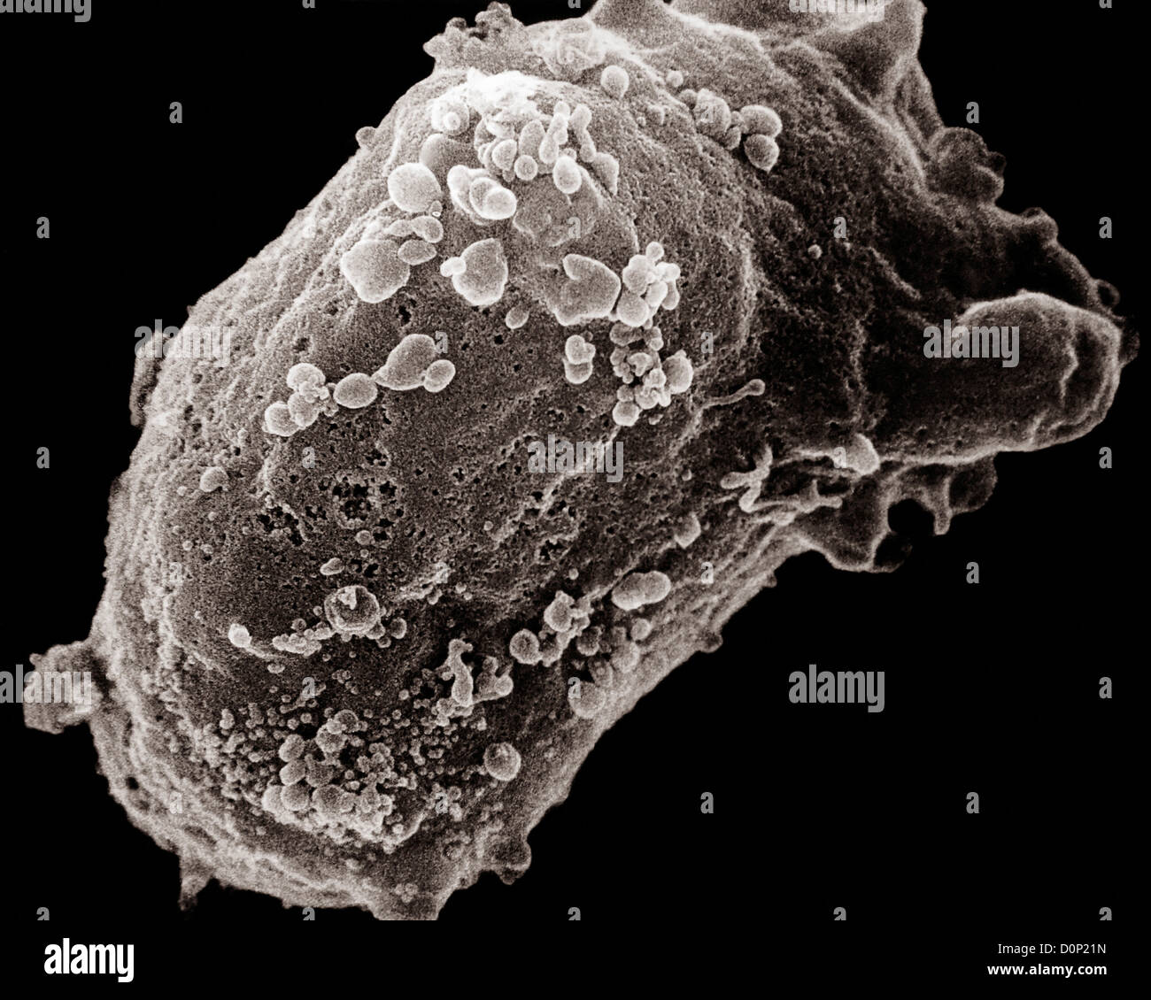 A scanning electron microscope image of a lymphocyte (white blood cell) with an HIV cluster. Stock Photo