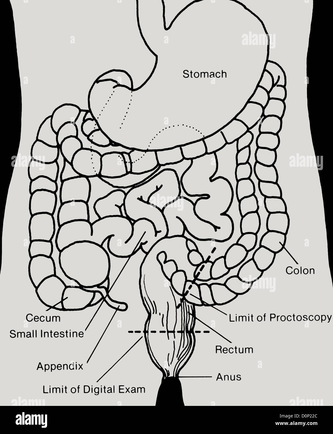 A diagram of the lower digestive track includes the limit of a rectal finger exam and proctoscopy. Stock Photo