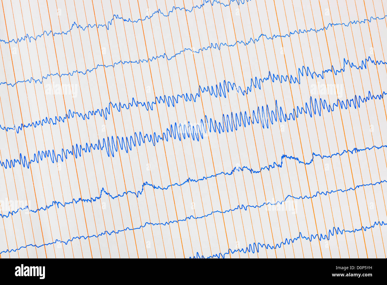 Electrocardiogram ecg hi-res stock photography and images - Alamy