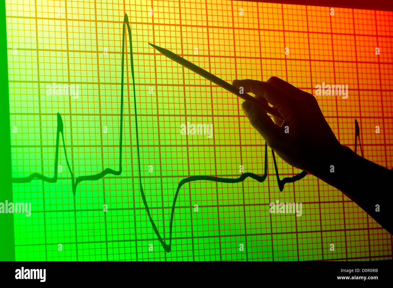 conceptual view of a  hand with a pointer projected on monitor of an EKG electrocardiogram Stock Photo