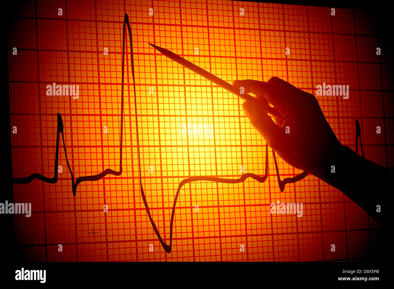 conceptual view of a hand with a pointer projected on monitor of an EKG electrocardiogram Stock Photo