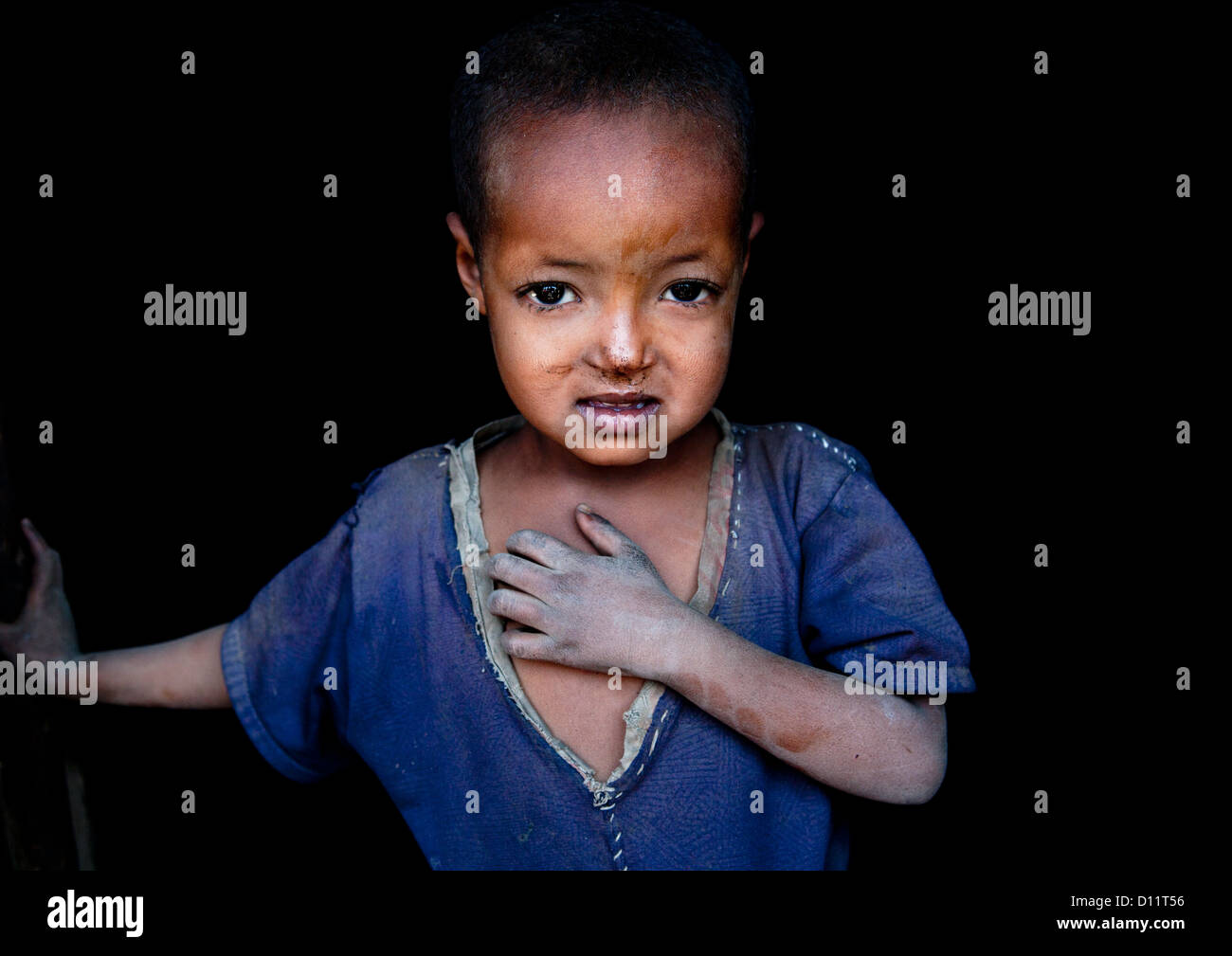Portrait Of A Poor Kid, Alaba, Ethiopia Stock Photo