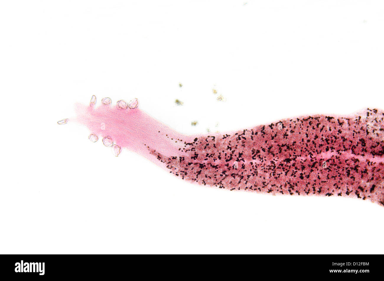 Hookworm hires stock photography and images Alamy