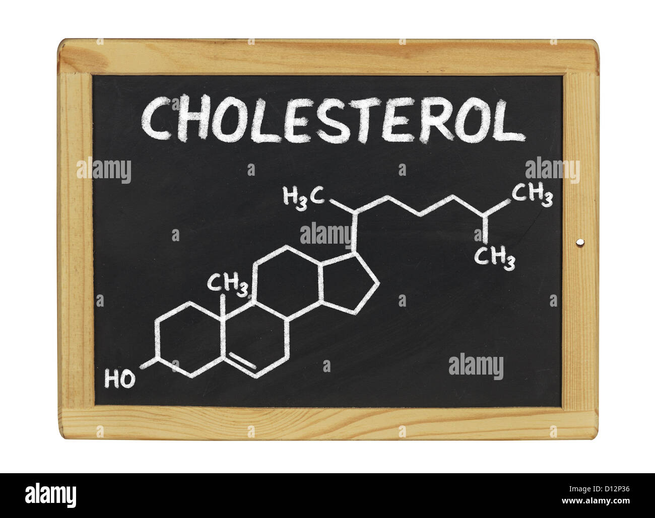 Cholesterol hires stock photography and images Alamy