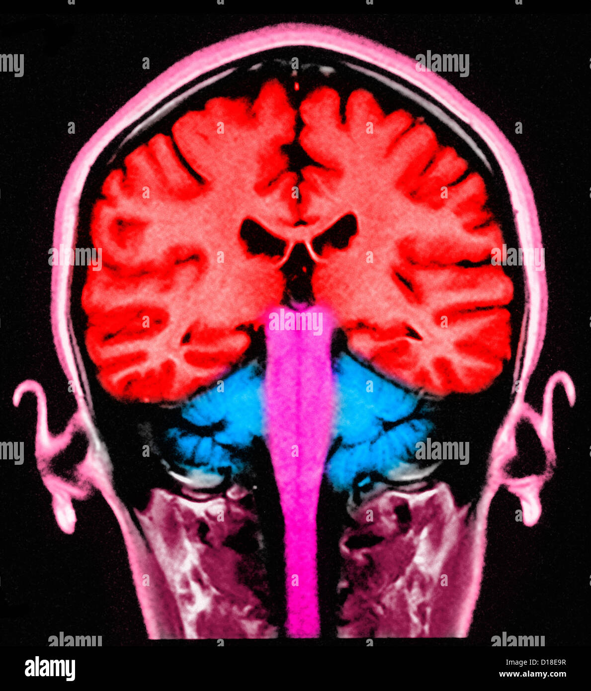 MRI brain sagital section normal Stock Photo