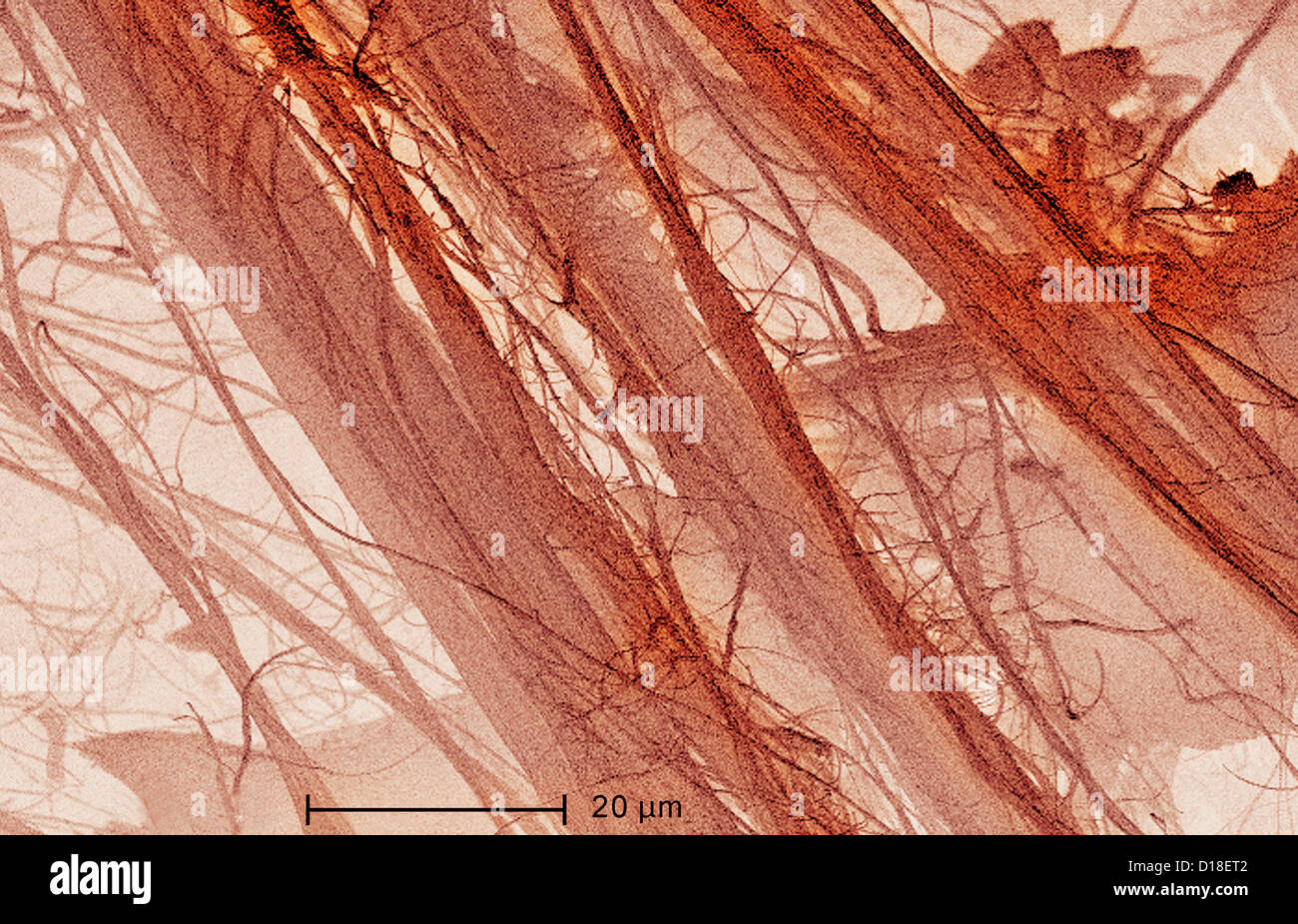 Scanning Electron micrograph of  asbestos, 1200x Stock Photo