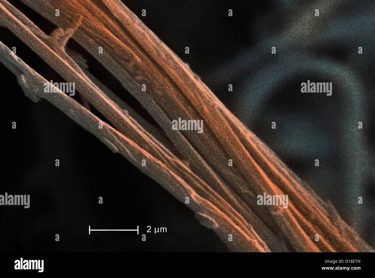Scanning Electron micrograph of asbestos, 8000x Stock Photo - Alamy