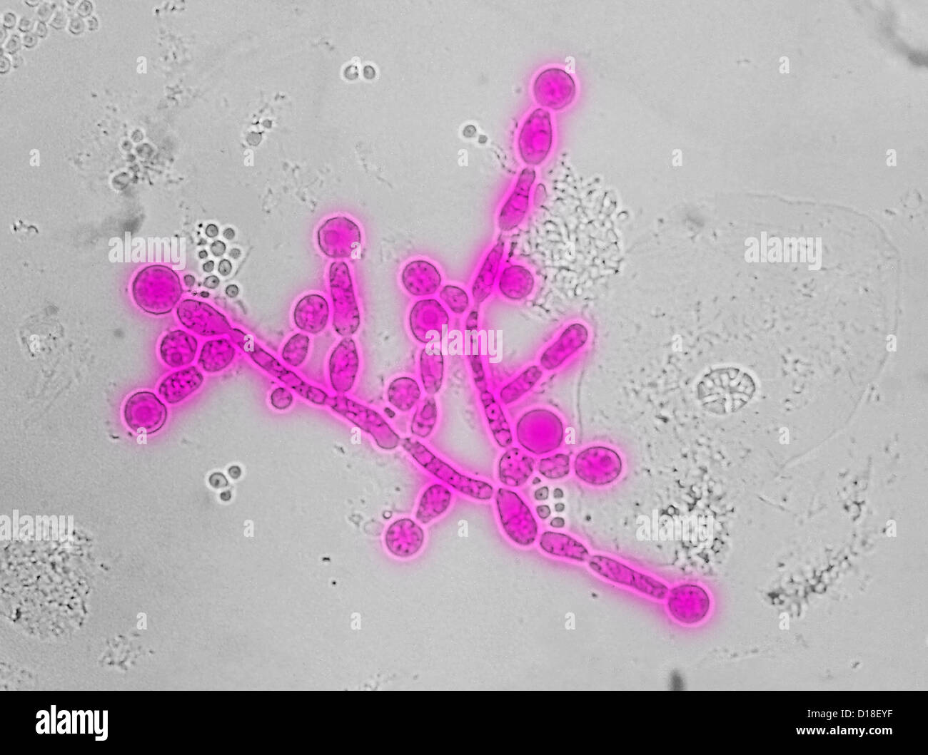 Electron micrograph of Candida chlamydospores Stock Photo