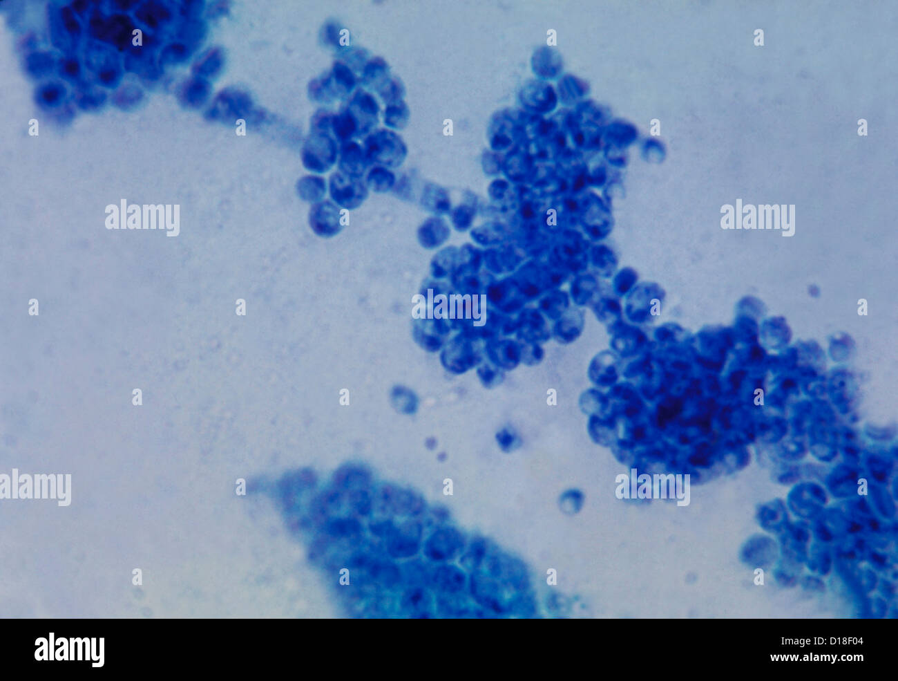 Photomicrograph of the fungus Candida albicans. Stock Photo