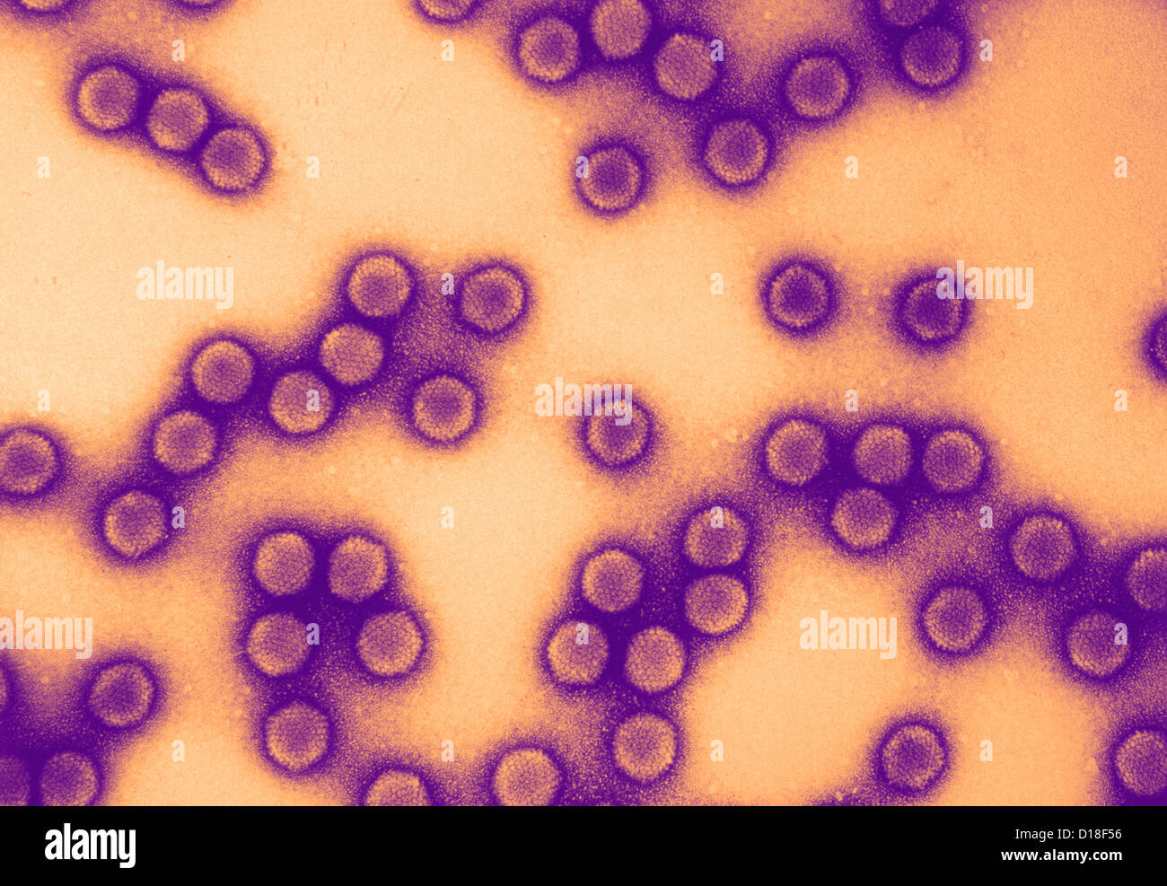 Electron micrograph of equine adenovirus Stock Photo