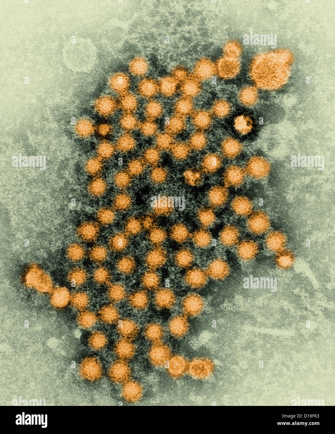 Electron micrograph of hepatitis virions Stock Photo