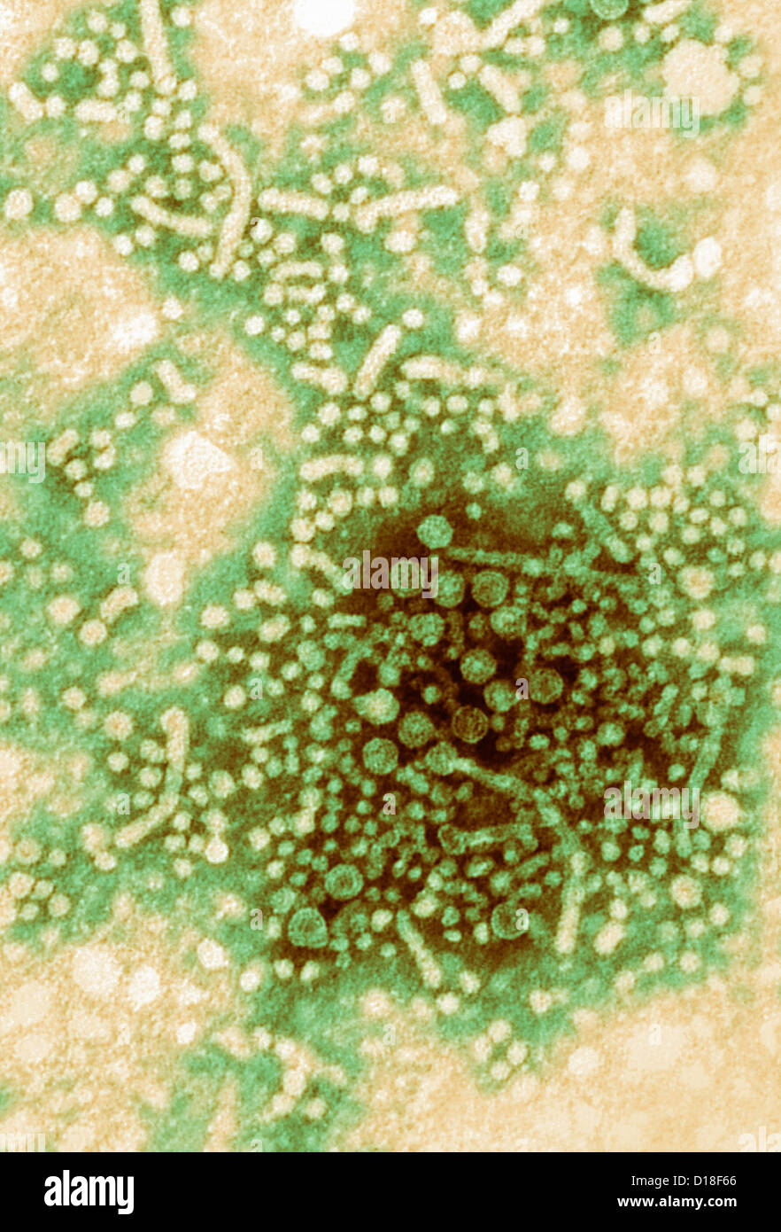 Electron micrograph, hepatitis B virus Stock Photo