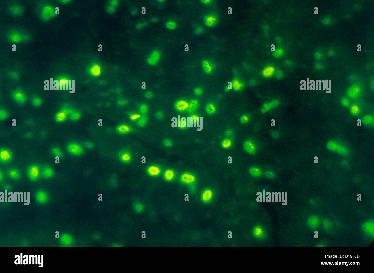 Electron micrograph of Haemophilus influenzae Stock Photo