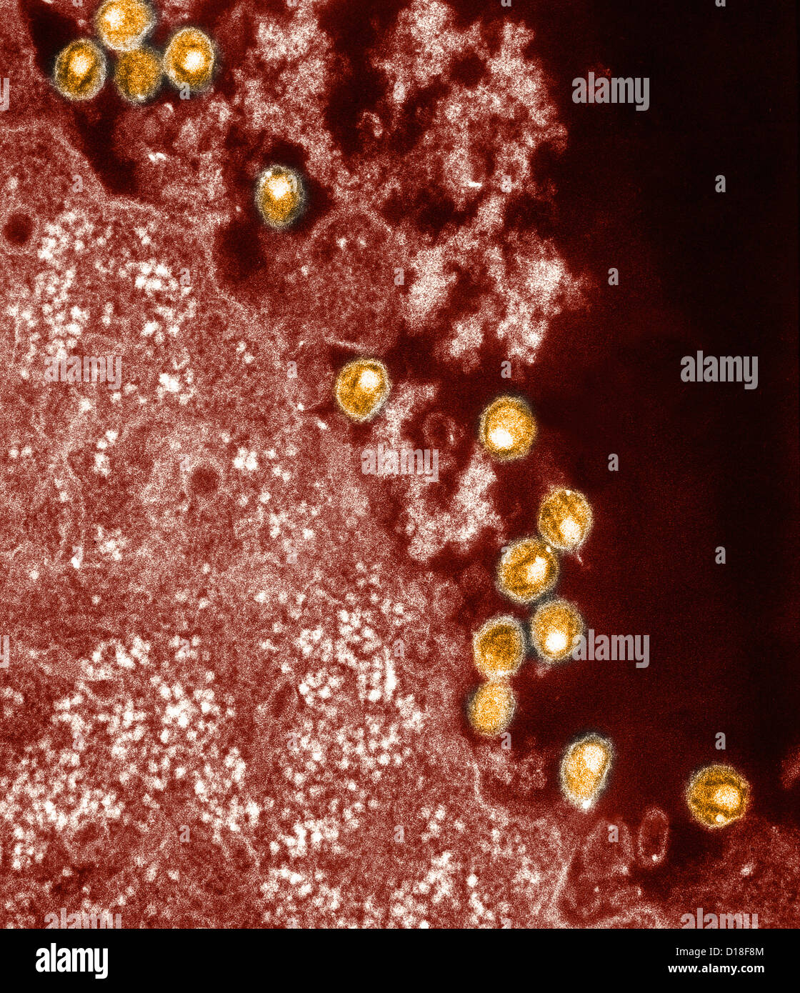 Electron micrograph of HIV virus Stock Photo