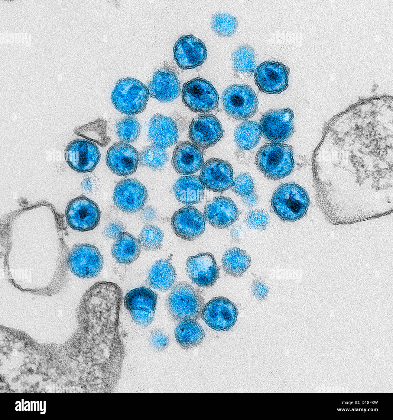 Electron micrograph of HIV virus Stock Photo