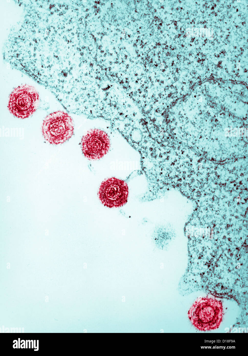 Electron micrograph of human herpes virus-6, HHV-6 Stock Photo