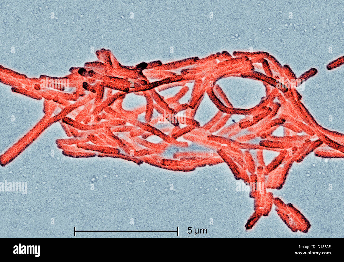 Electron micrograph of Legionella bacteria, 6500x Stock Photo