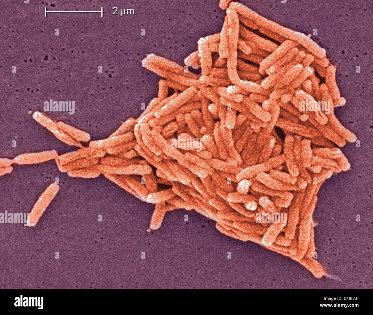 Electron micrograph of Legionella bacteria, 6500x Stock Photo Alamy