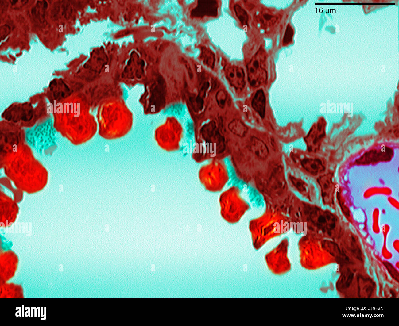 Photomicrograph of bronchiolar epithelium tissue Stock Photo