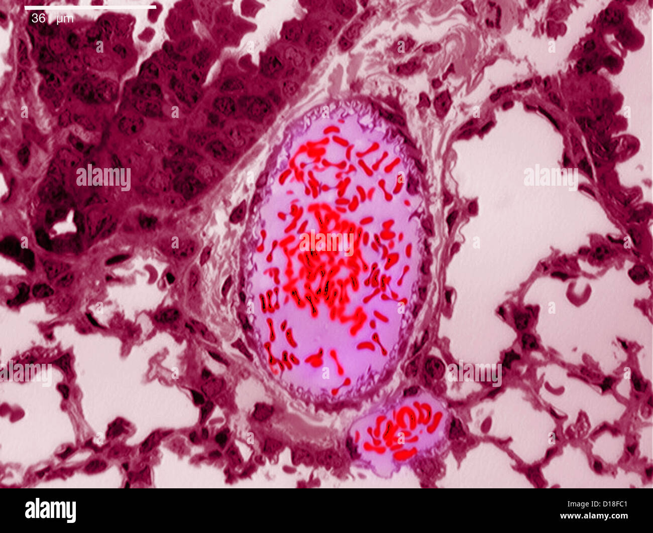 Photomicrograph of bronchiolar epithelium tissue Stock Photo