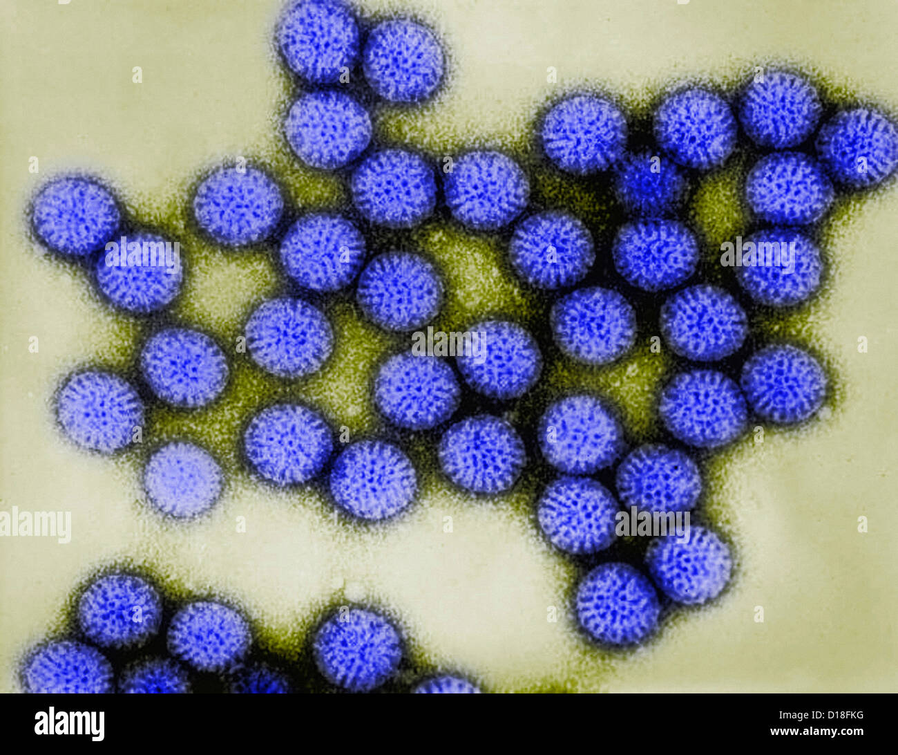 Transmission Electron micrograph of rotavirus Stock Photo