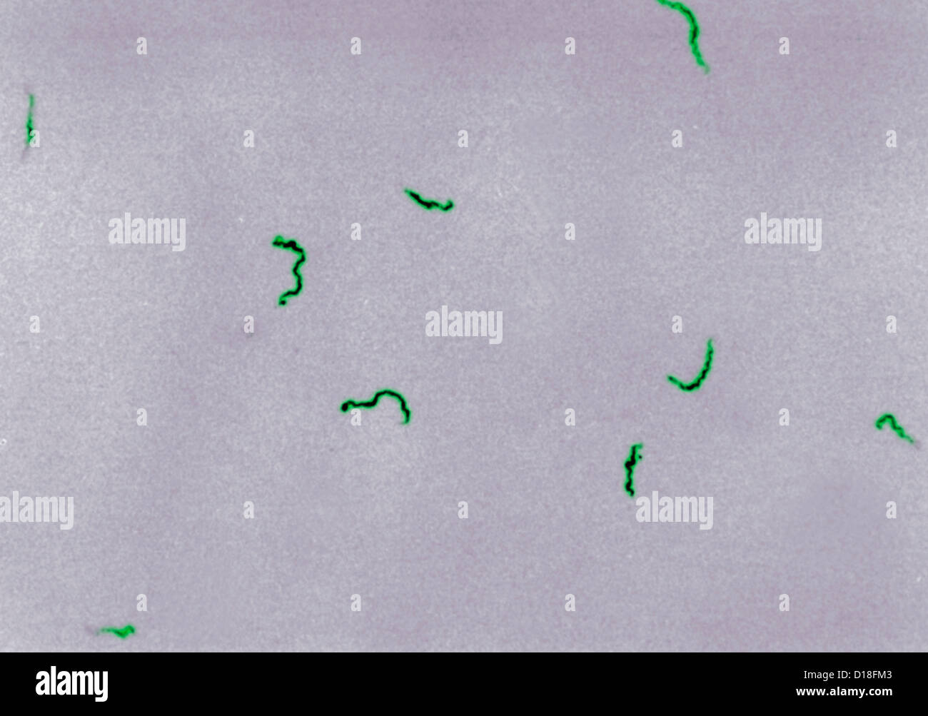 Photomicrograph of Treponema pallidum bacteria Stock Photo