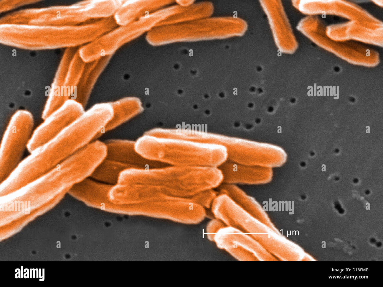 Electron micrograph of Mycobacterium tuberculosis Stock Photo