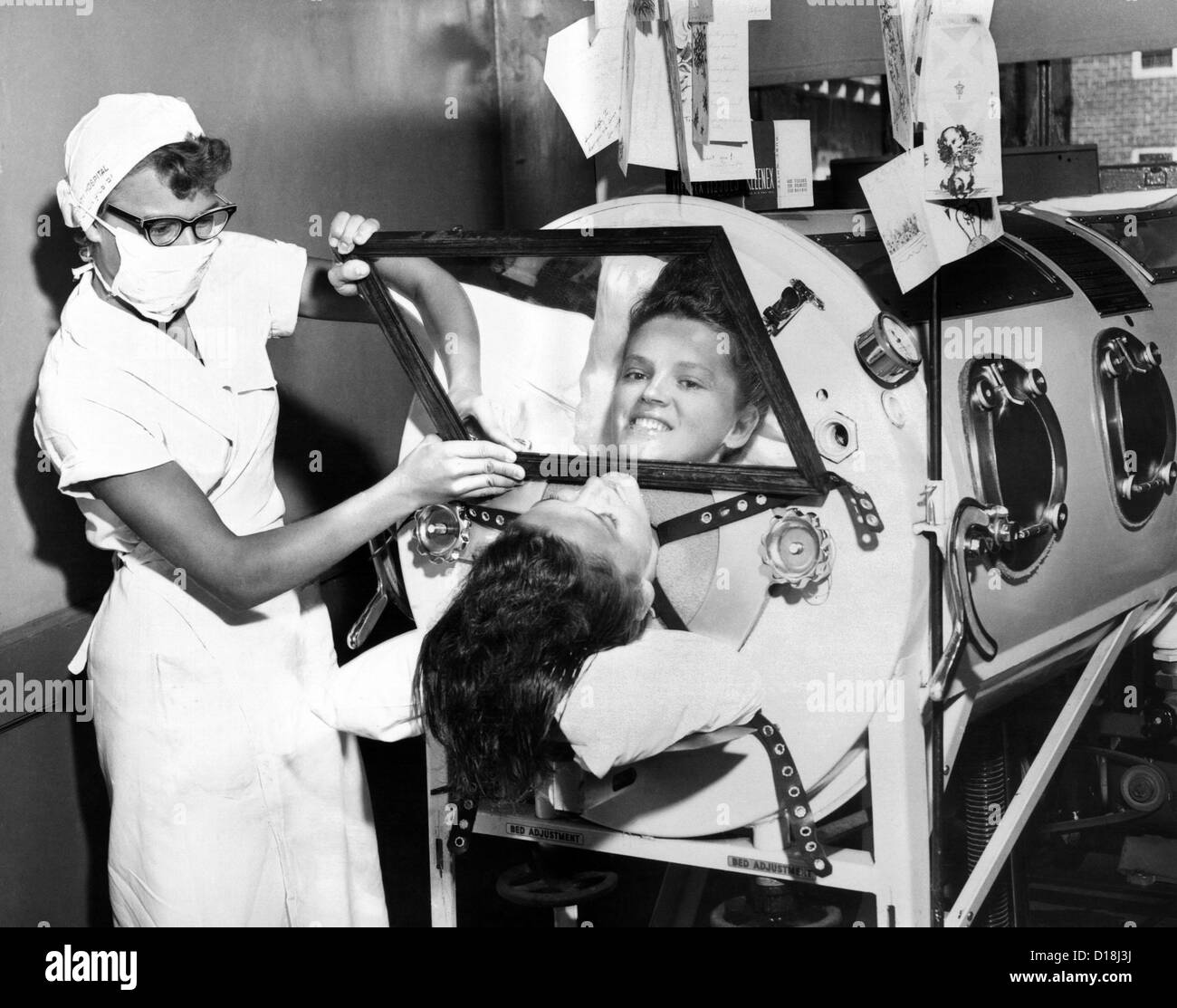 Polio patient Flossie Rogers looking at the world through the mirror of her iron lung in June 1957. She recovered and became a Stock Photo