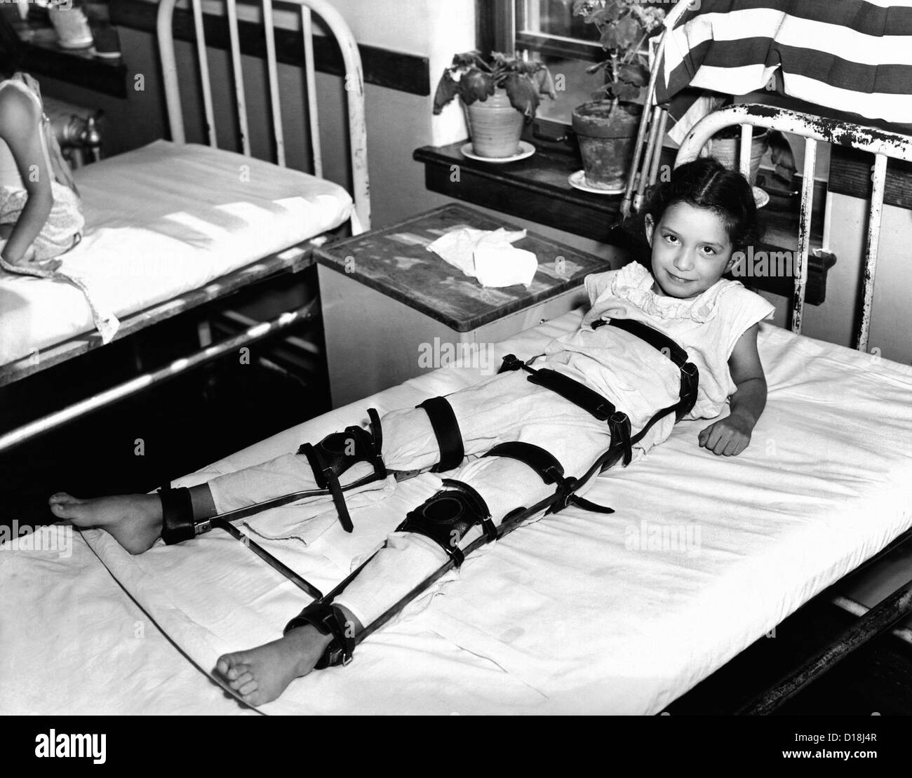 Young Polio victim in bed with a body and leg brace. Sept. 18, 1937. (CSU ALPHA 1224) CSU Archives/Everett Collection Stock Photo