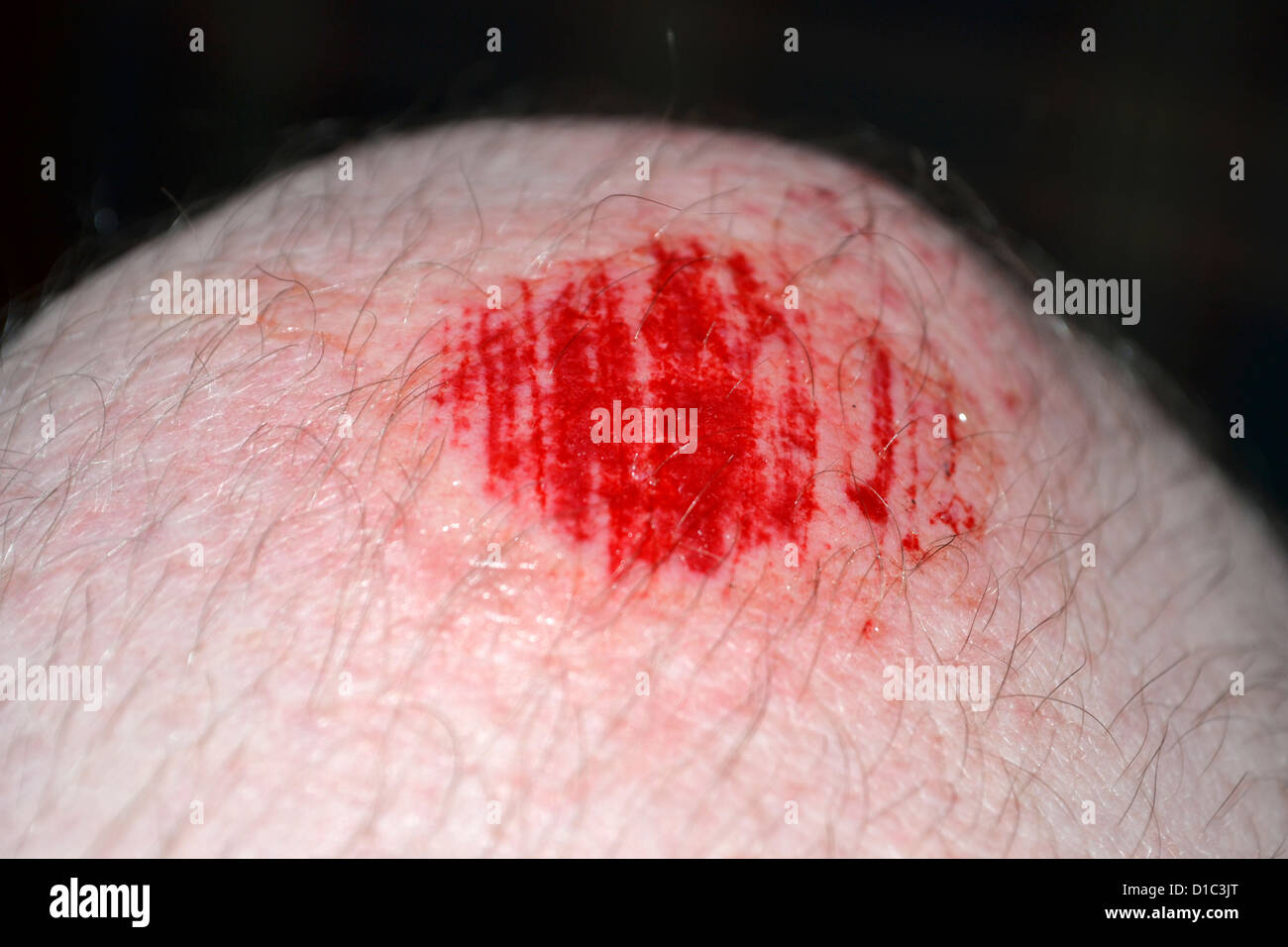 closeup of mans scraped knee Stock Photo Alamy