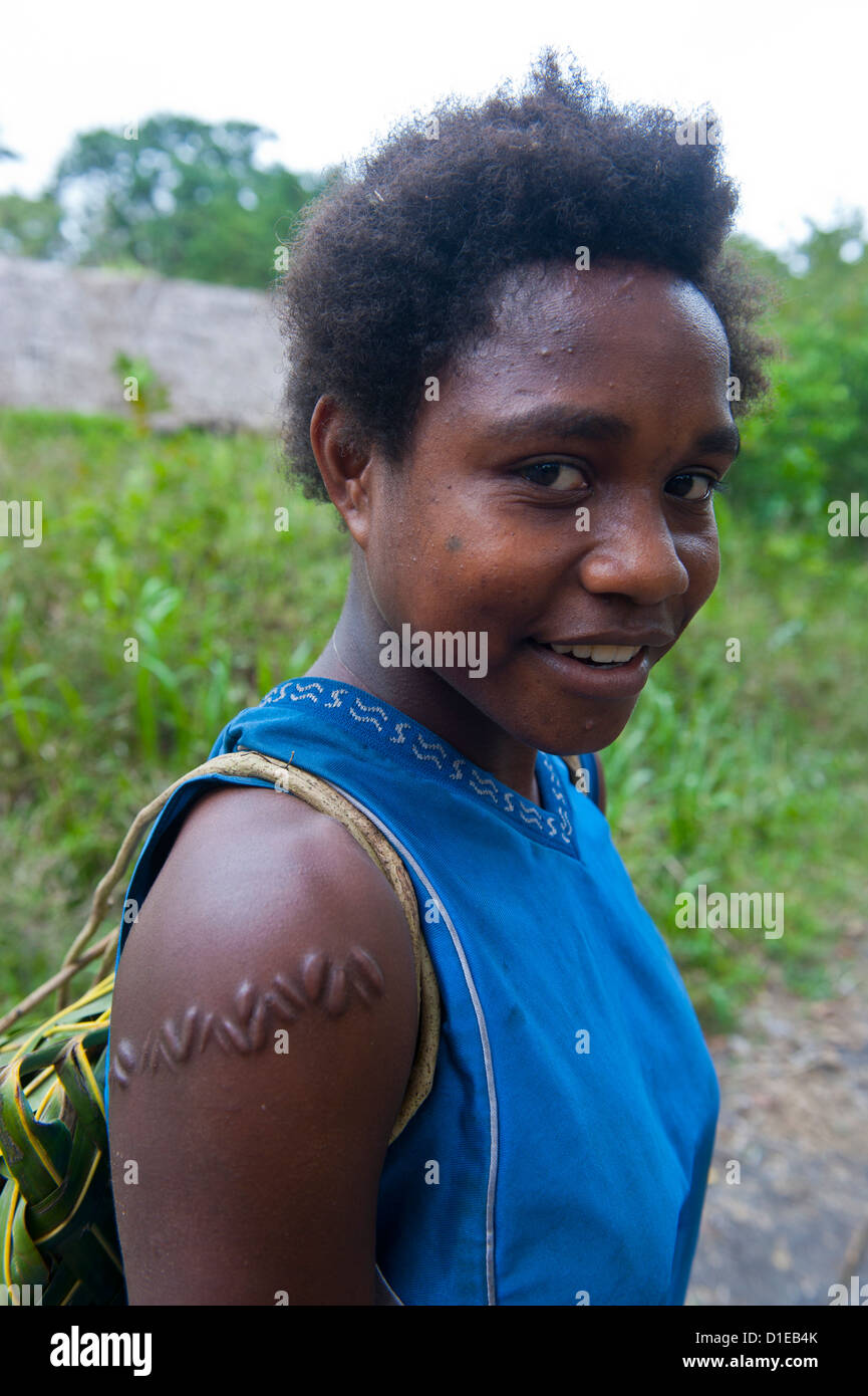 Local girl with typical scar near, Volcano Yasur, Island of Tanna, Vanuatu, South Pacific, Pacific Stock Photo