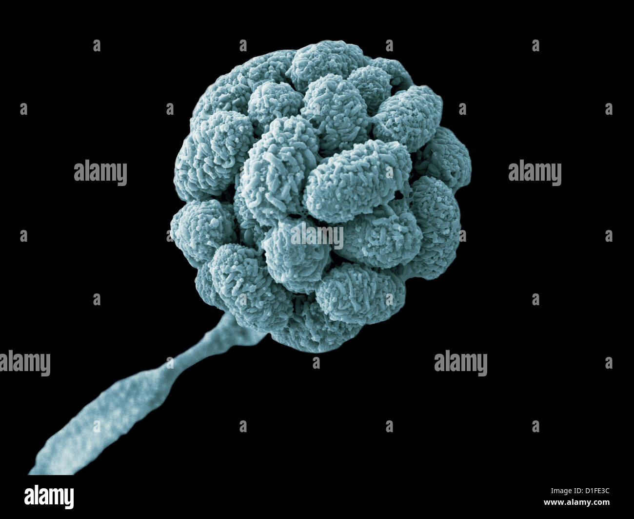 SEM - STACHYBOTRYS CHARTARUM Stock Photo
