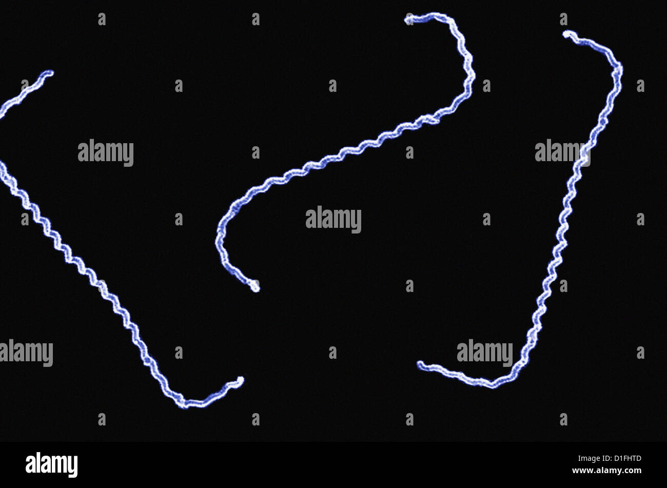 SEM - LEPTOSPIRA INTERROGANS Stock Photo