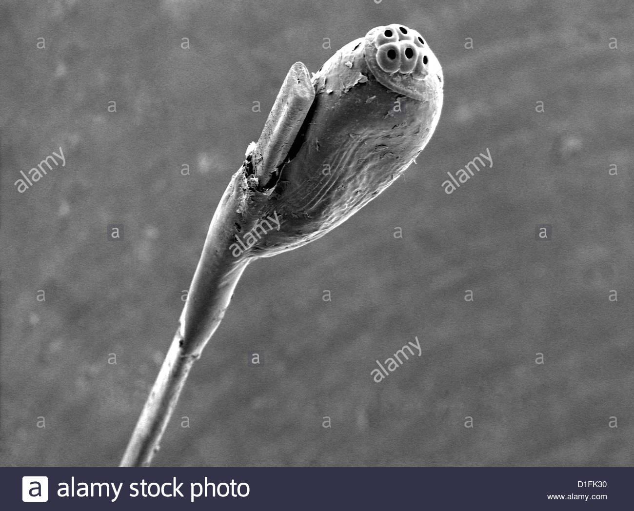 Sem Head Louse Egg On Hair Stock Photo 52590020 Alamy