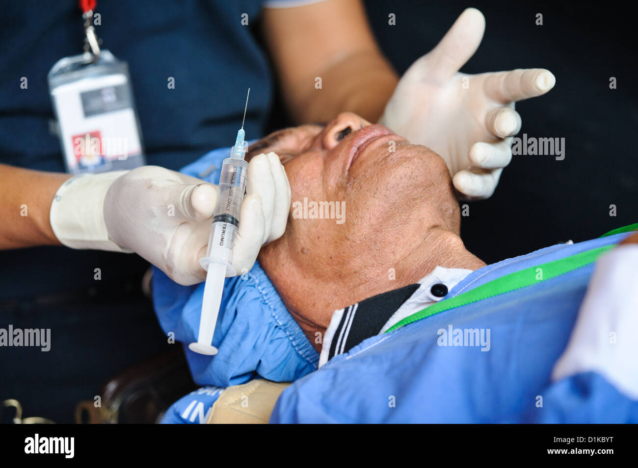 A patient being injected with local anaesthetic prior to surgery to