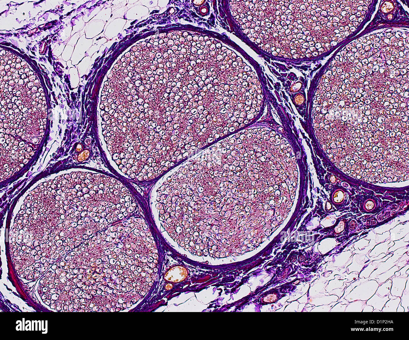 Nerve fibres, light micrograph Stock Photo