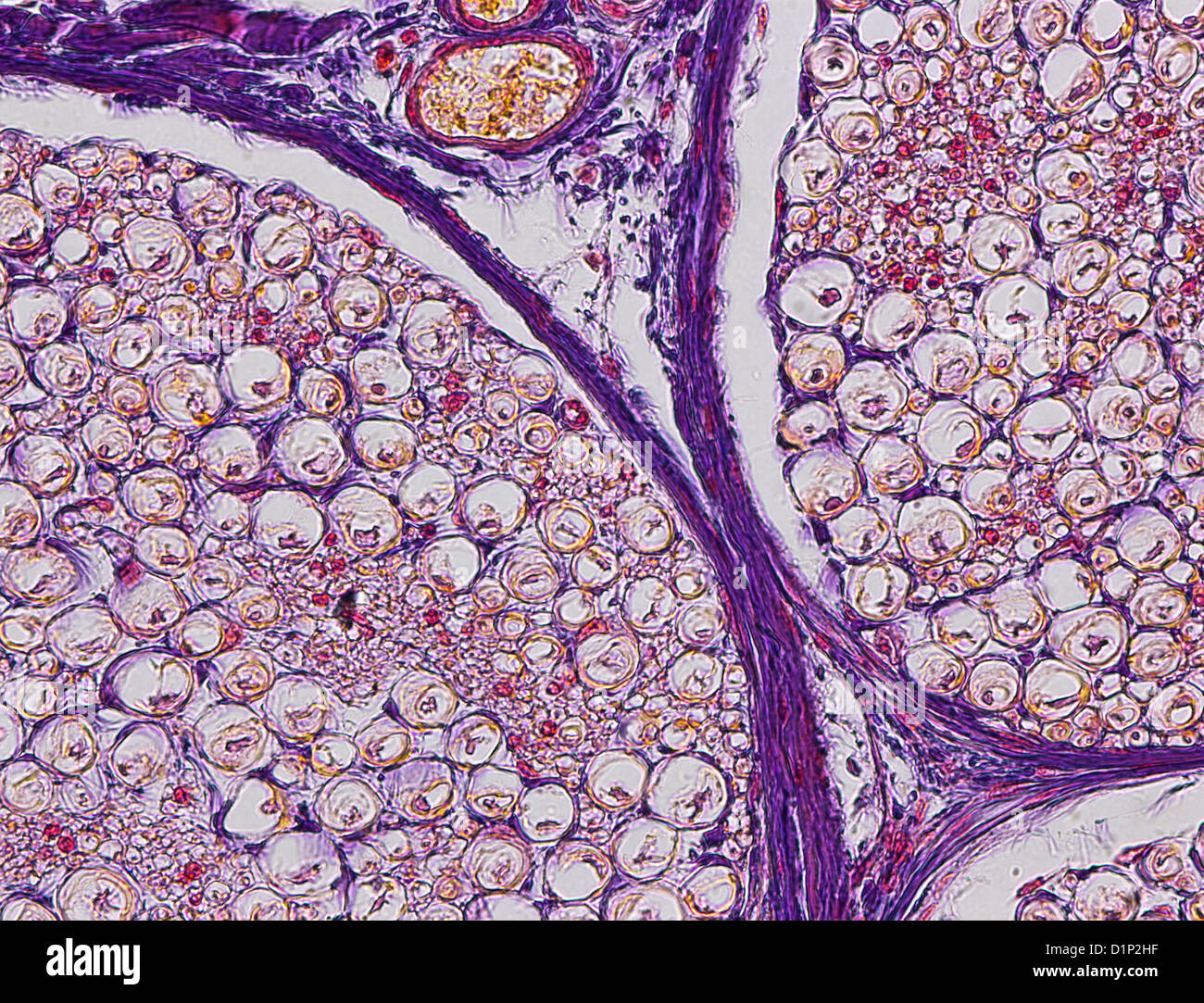 Nerve fibres, light micrograph Stock Photo - Alamy