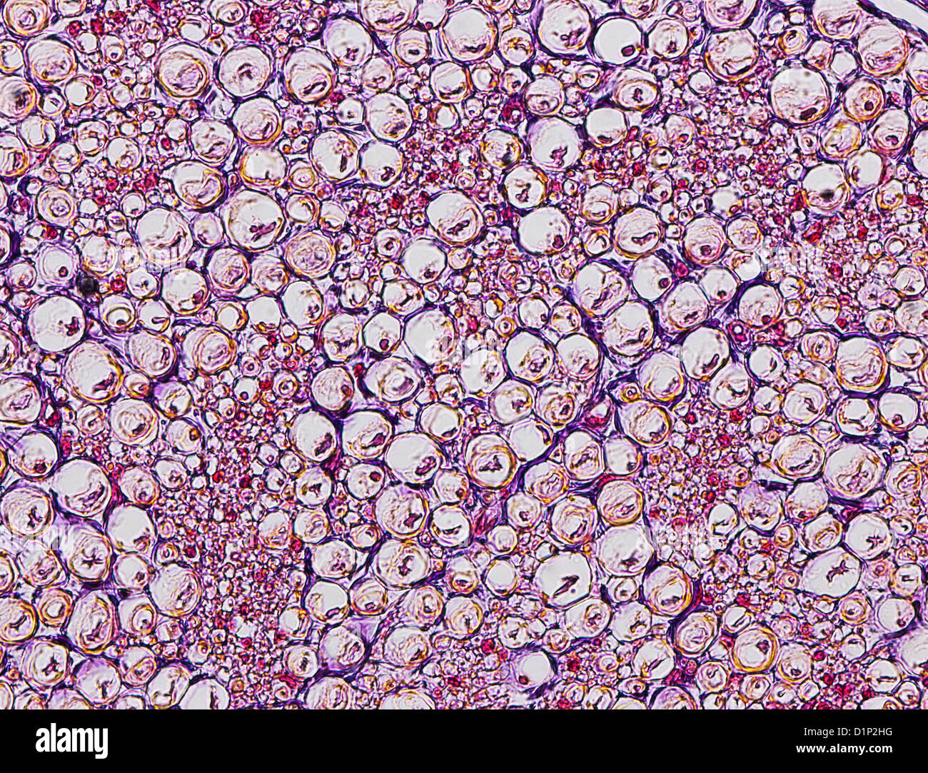 Nerve fibres, light micrograph Stock Photo - Alamy