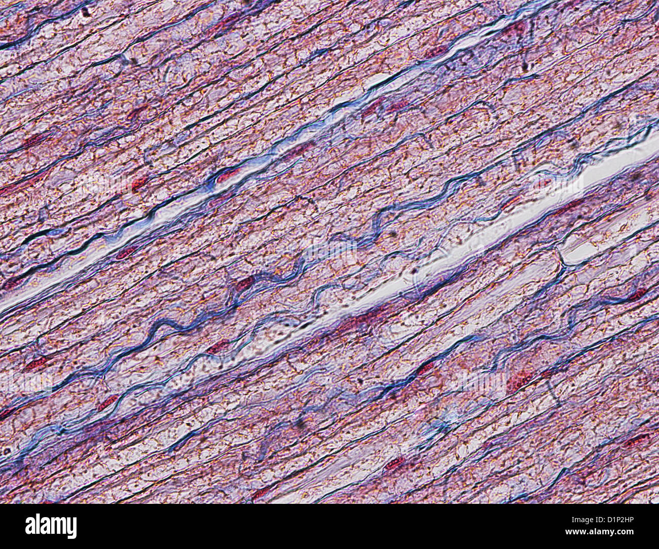Nerve fibres, light micrograph Stock Photo - Alamy