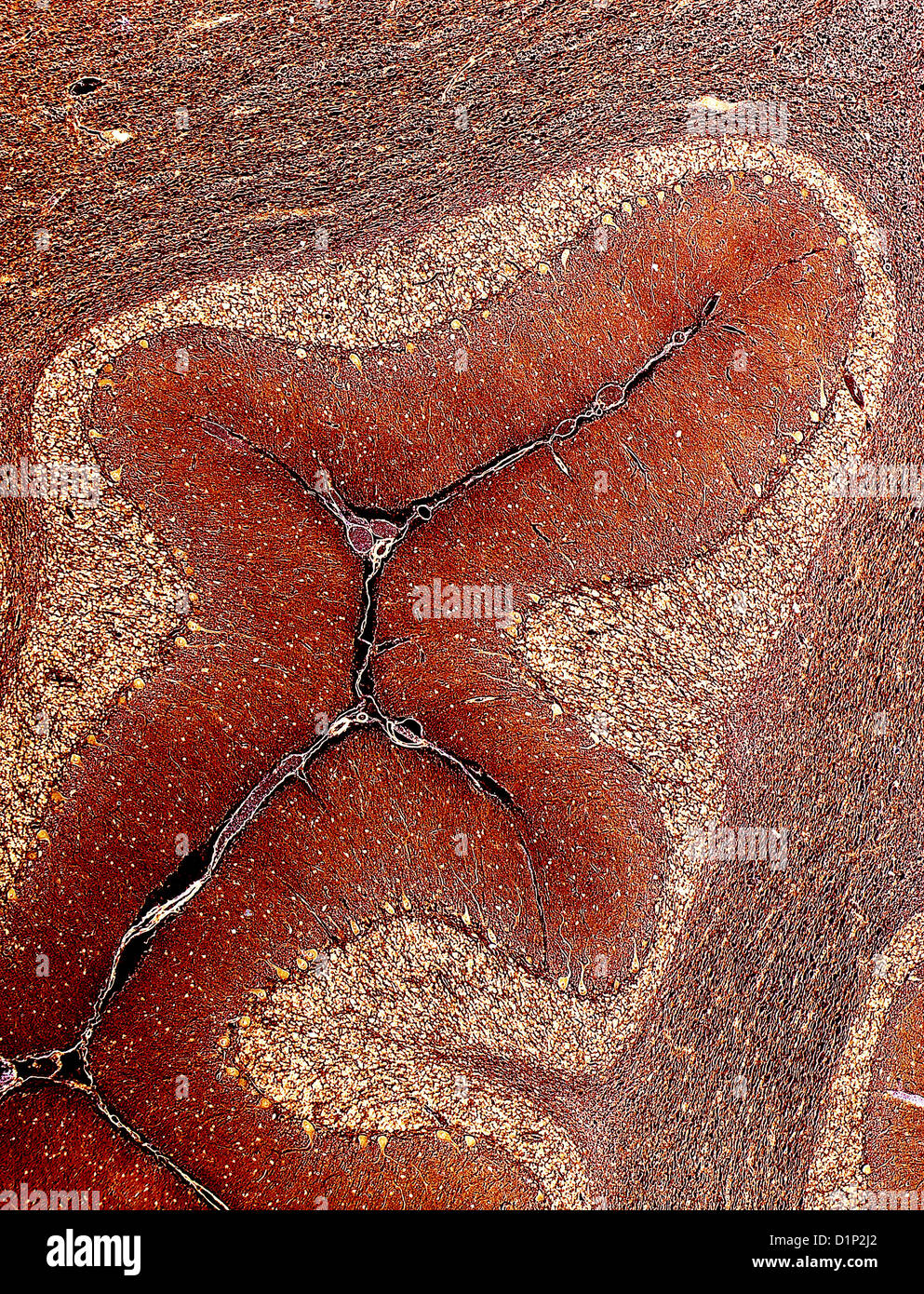 Cerebellum tissue, light micrograph Stock Photo